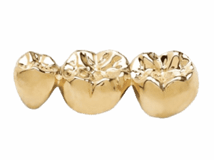 sell dental gold, sell gold crowns