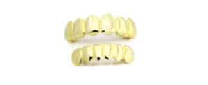 This is a Gold Grill - We Buy Gold Grillz